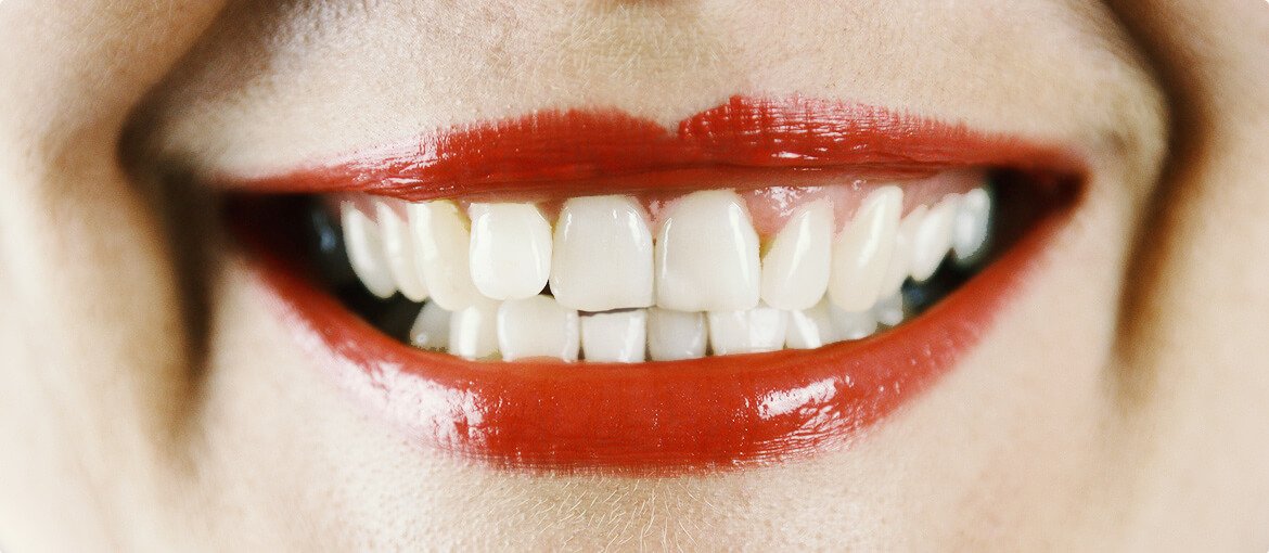 After dental treatment