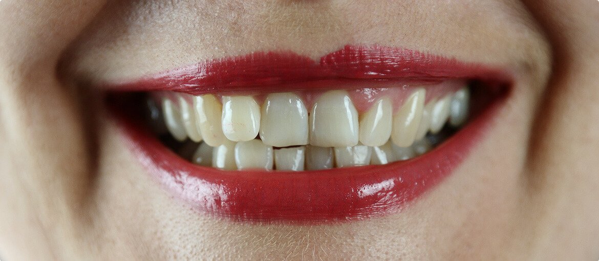 Before dental treatment